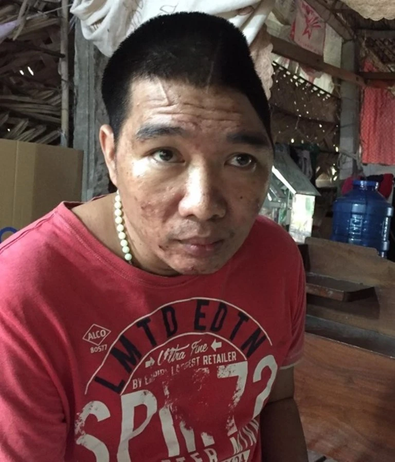 Mẹ nghèo nuôi con bệnh tật